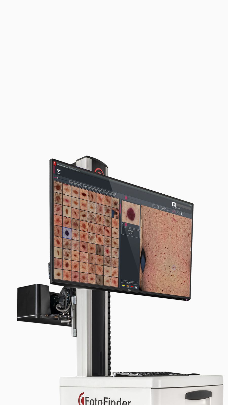 Écran 4K Fotofinder ATBM Master.